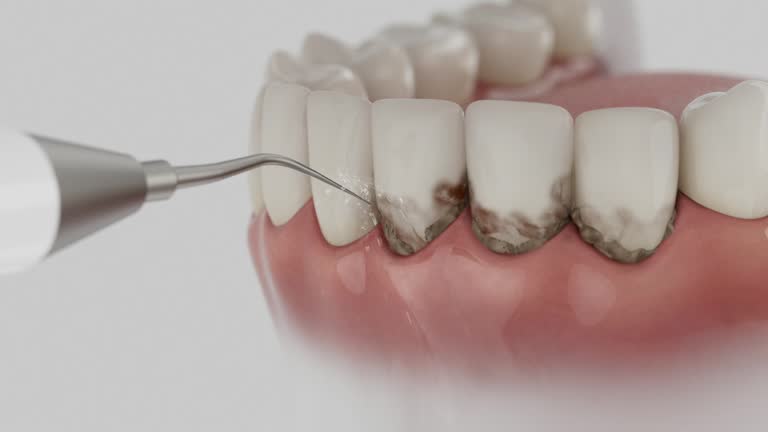 Trusted Invisalign Clear Aligners service in Denton, MD - Dentist Open Now